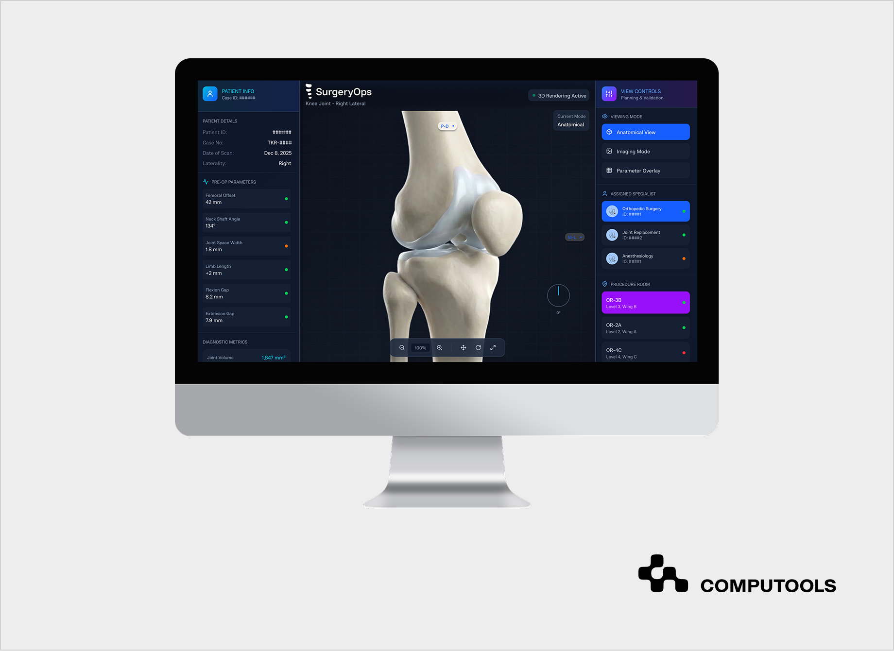 SurgeryOps case study screen picture